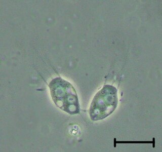 <span class="mw-page-title-main">Choanozoa</span> Clade of opisthokont eukaryotes consisting of the choanoflagellates and the animals