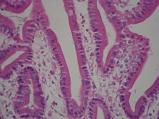 Brush border The dense covering of microvilli on the apical surface of a epithelial cells in tissues such as the intestine, kidney, and choroid plexus; the microvilli aid absorption by increasing the surface area of the cell.