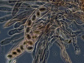 <span class="mw-page-title-main">Ascus</span> Spore-bearing cell in ascomycete fungi