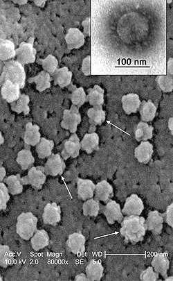 SARS-CoV under elektronmikroskop