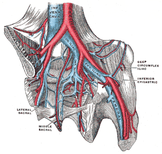 <span class="mw-page-title-main">May–Thurner syndrome</span> Medical condition