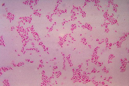 Bacteroides fragilis (Bacteroidetes)