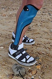 Customised foot orthoses can offer short-term pain relief Orthese am Strand.jpg