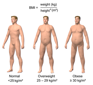 <span class="mw-page-title-main">Classification of obesity</span> Overview of the classification of the condition of obesity