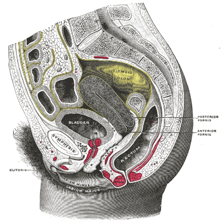 Cross-sectional diagram showing the uterus, cervix, fornix on either side of the cervix, vagina, and pubic bone. Ring-shaped cups lie in the upper portion of the vagina, with the inner edge in the posterior fornix and outer one held in behind the pubic bone, within the pelvic floor. Gray1166.png