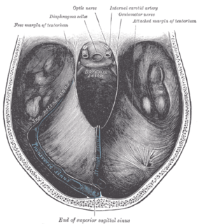 <span class="mw-page-title-main">Tentorial notch</span>