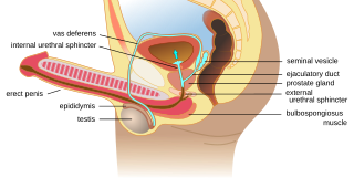 <span class="mw-page-title-main">Retrograde ejaculation</span> Redirection of ejaculated semen into the urinary bladder