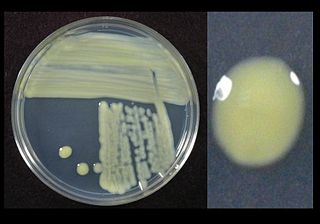 <i>Xanthomonas</i> Genus of bacteria