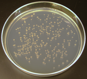 Colonies of E. coli produced by cellular cloning. A similar methodology is often used in molecular cloning. Ecoli colonies.png