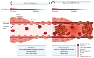 <span class="mw-page-title-main">Endothelial dysfunction</span>