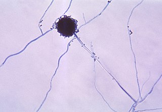 <i>Aspergillus niger</i> Species of fungus