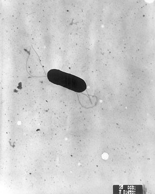 <span class="mw-page-title-main">Listeriosis</span> Medical condition