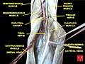 Tibial nerve.jpg