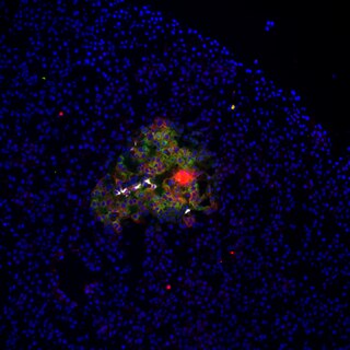 <span class="mw-page-title-main">Beta cell</span> Type of cell found in pancreatic islets