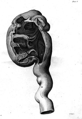 <span class="mw-page-title-main">Nephritis</span> Inflammation of the kidneys