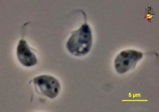 <span class="mw-page-title-main">Malawimonadidae</span> Family of protists