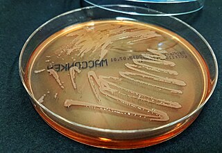 <i>Stenotrophomonas maltophilia</i> Species of bacterium