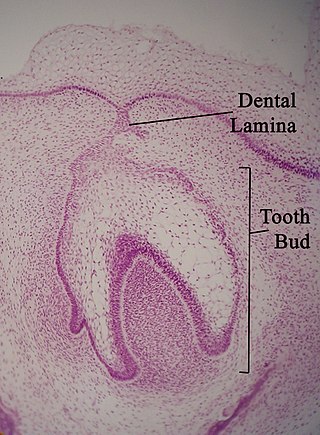 <span class="mw-page-title-main">Dental lamina</span> Band of epithelial tissue