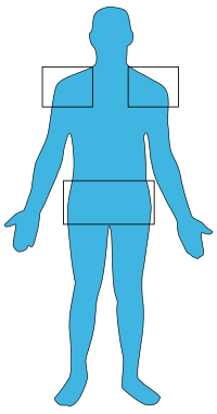 Polymyalgia rheumatica man.svg