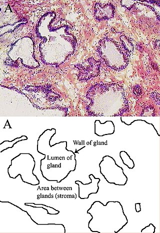 <span class="mw-page-title-main">Stroma (tissue)</span> Part of a tissue or organ with a structural or connective role