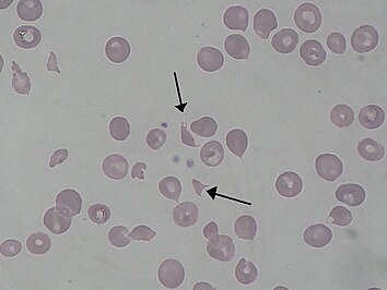 Bacterias vistas en microscopio electrónico de barrido