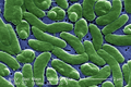 Image 119Vibrio vulnificus, a virulent bacterium found in estuaries and along coastal areas (from Marine prokaryotes)