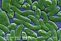 Image 69Vibrio vulnificus, a virulent bacterium found in estuaries and along coastal areas (from Marine prokaryotes)