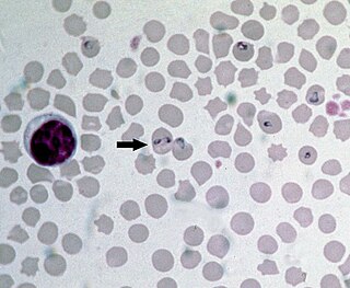 <i>Babesia bovis</i> Species of single-celled organism