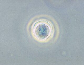 <i>Acanthamoeba</i> Genus of protozoans