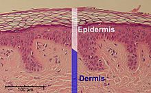 Epidermis-delimited.JPG