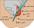 العربية (GIF)