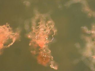 <span class="mw-page-title-main">Acrasidae</span> Family of slime moulds