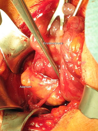 <span class="mw-page-title-main">Parathyroidectomy</span> Surgical removal of one or more of the parathyroid glands