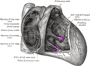 <span class="mw-page-title-main">Papillary muscle</span> Heart ventricle muscles