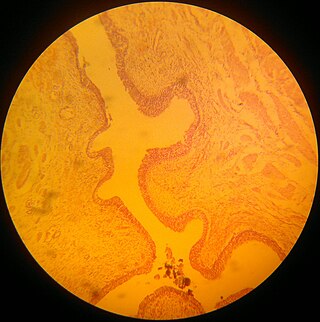 <span class="mw-page-title-main">Transitional epithelium</span> A type of tissue