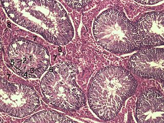 <span class="mw-page-title-main">Myofibroblast</span> Cell type with functions of both muscular and fibrous connective tissue