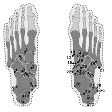 Location of accessory tarsal bones Tarsalia accessoria.png