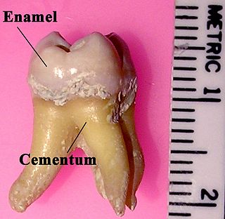 <span class="mw-page-title-main">Tooth enamel</span> Major tissue that makes up part of the tooth in humans and many other animals