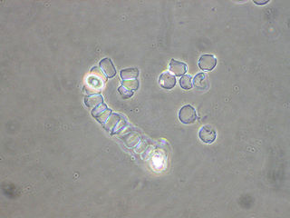 <span class="mw-page-title-main">Discicristata</span> Taxonomic clade