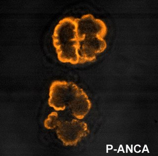 <span class="mw-page-title-main">Anti-neutrophil cytoplasmic antibody</span> Group of autoantibodies