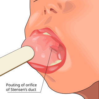 <span class="mw-page-title-main">Parotitis</span> Medical condition