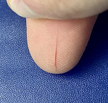 An open paper cut, a few minutes after injury, on the right thumb.