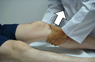 <span class="mw-page-title-main">Lachman test</span> Clinical test to diagnose injury to ligaments