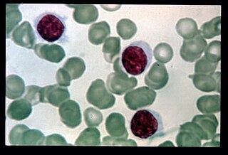 <span class="mw-page-title-main">Hairy cell leukemia</span> Hematological malignancy