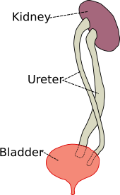 Duplicated ureter Duplicated ureter.svg