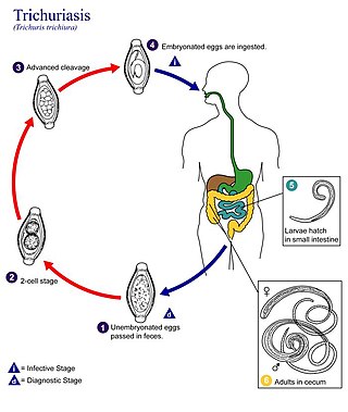 <span class="mw-page-title-main">Trichuriasis</span> Infection by Trichuris trichiura (whipworm)