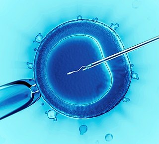 <span class="mw-page-title-main">In vitro fertilisation</span> Assisted reproductive technology procedure