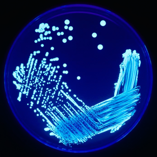 <span class="mw-page-title-main">Streaking (microbiology)</span> Method for isolation of bacterial strains