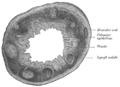 Transverse section of human vermiform process.