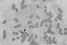 Silver-stained nucleolus organizer region (arrow) at the tip of a chromosome of the Gecko Lepidodactylus lugubris NORAgc.jpg